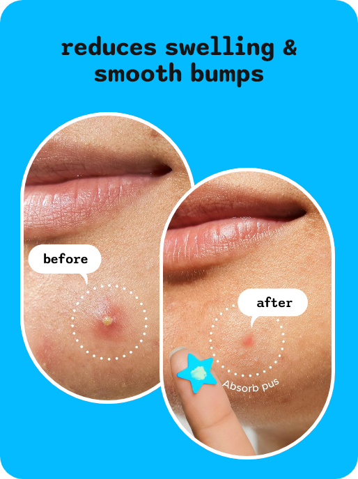 Dermple Blue Slide