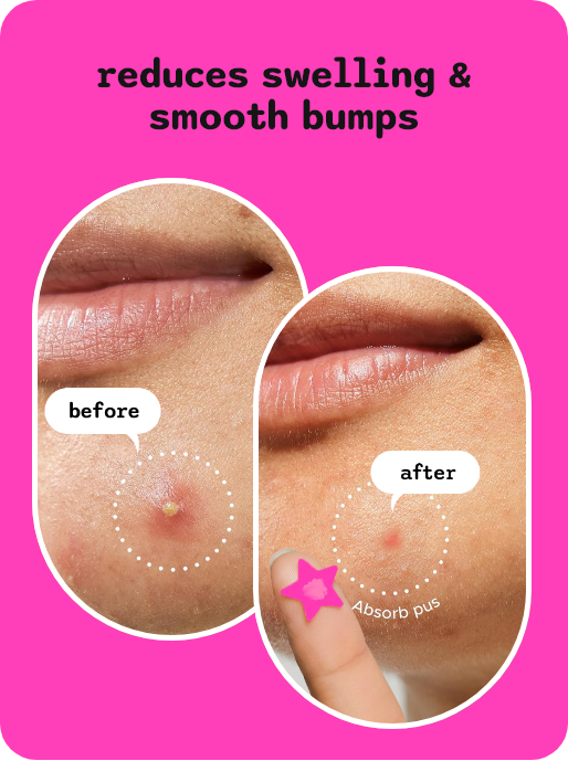 Dermple Pink Slide