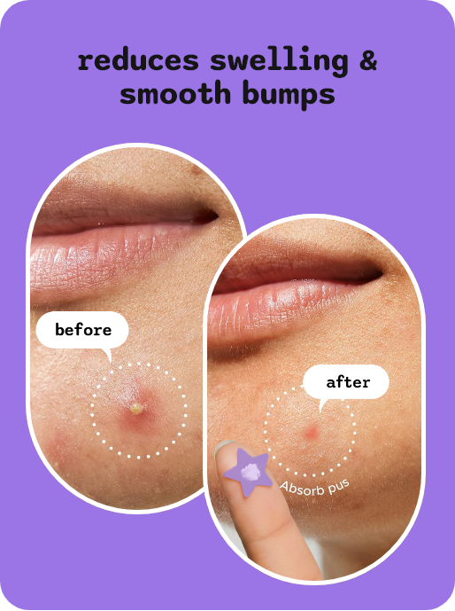 Dermple Purple Slide