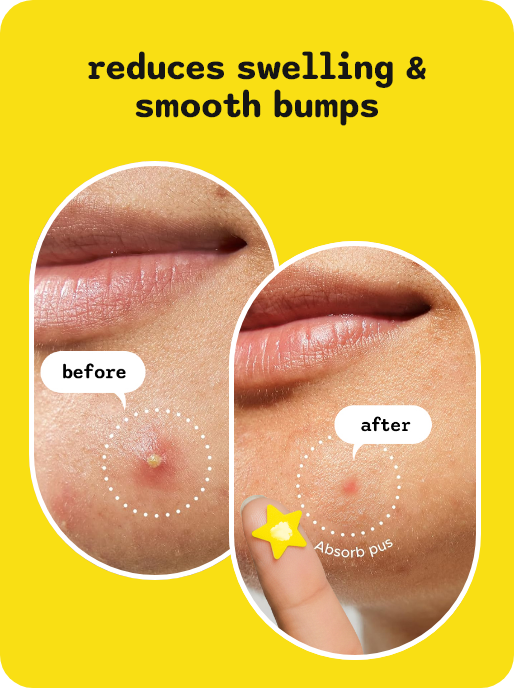 Dermple Yellow Slide